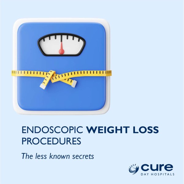 Endoscopic Weight Loss Procedures – The less known secrets – Cure Day ...